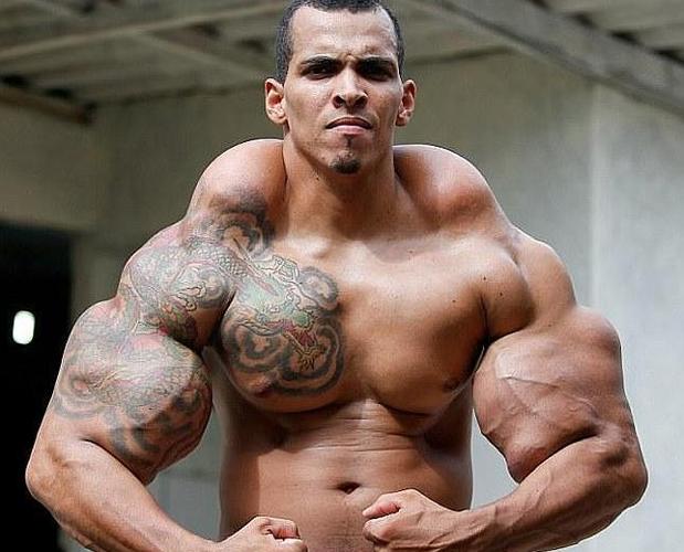 El Hulk brasileño perdió peso para que no le amputaran los brazos